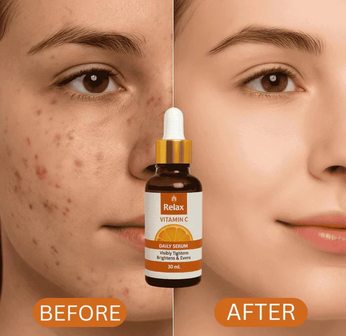 Relax Vitamin C Daily Serum – Glow & Radiance in Every Drop